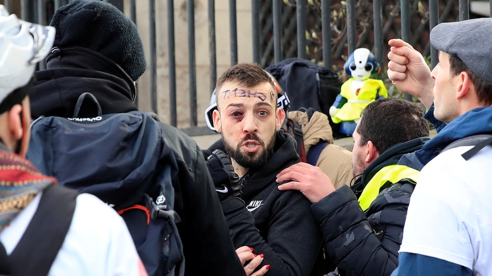 'It was his right to protest, now he has no livelihood’ – Yellow Vest on demonstrator who lost hand